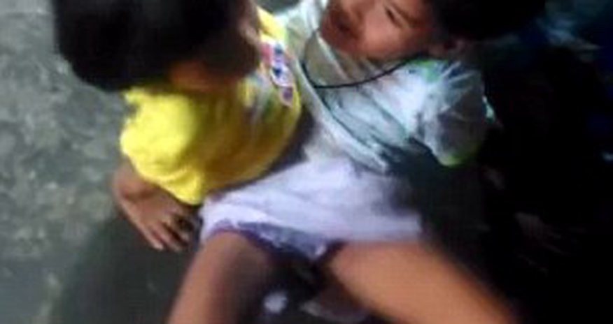 Seven-year-old twins joined at the waist since birth happily walking together Seven-year-old twins joined at the waist since birth happily walking together