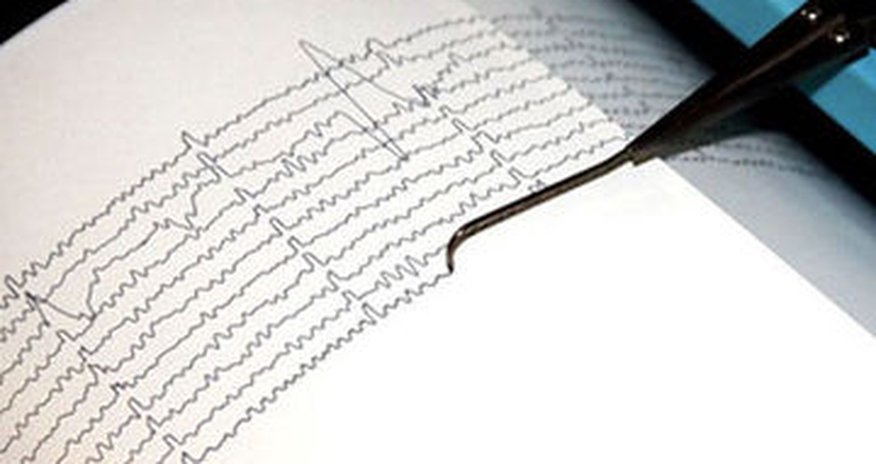 Quake hits Tovuz Quake hits Tovuz