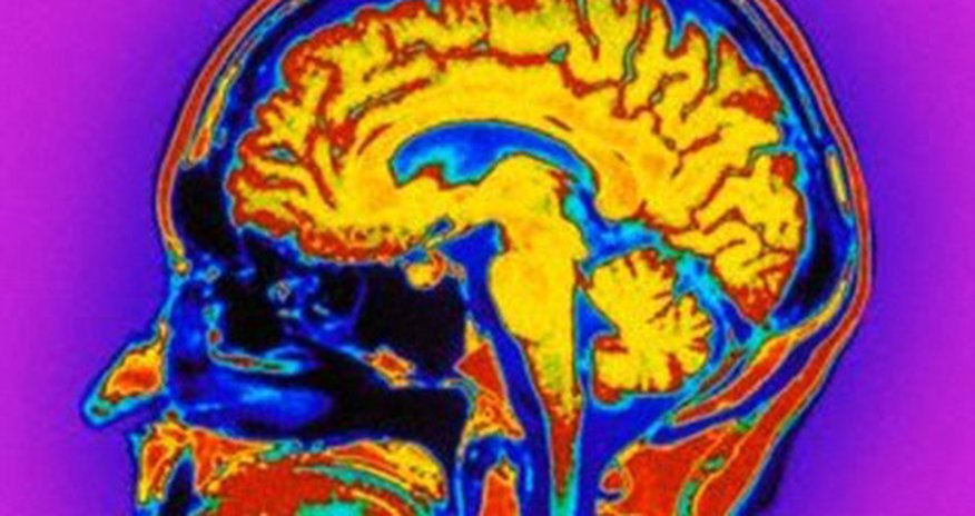 Do YOU have autistic traits? Do YOU have autistic traits?