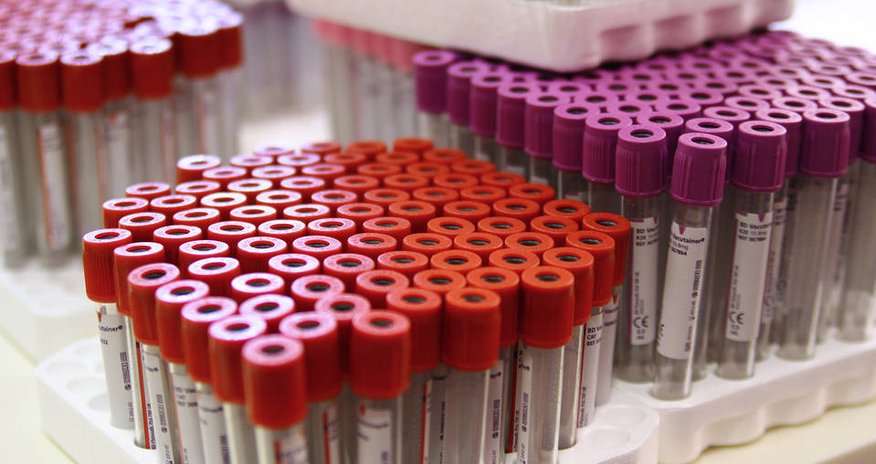 France to abolish ban on blood donation for gay men France to abolish ban on blood donation for gay men