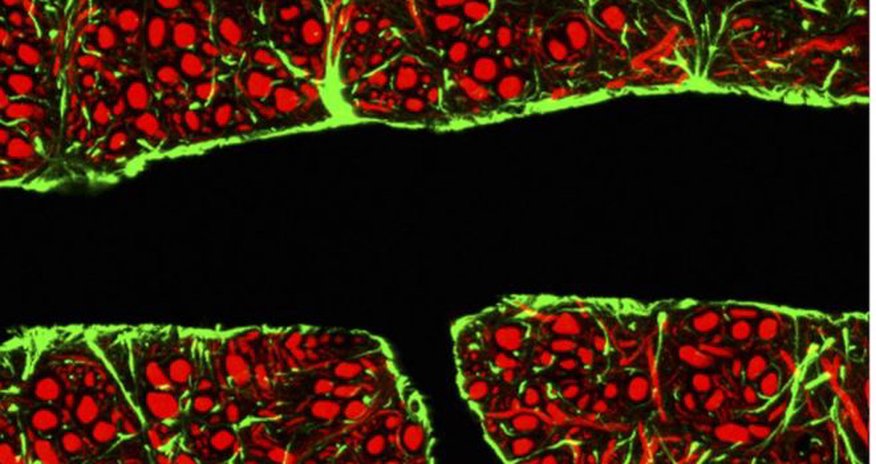 Scientists breach brain barrier to treat sick patient Scientists breach brain barrier to treat sick patient