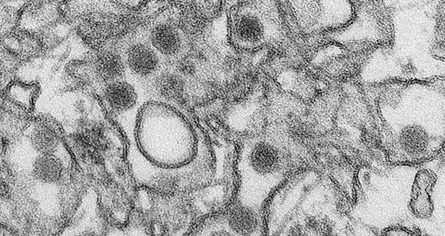 What is the Zika virus? What is the Zika virus?