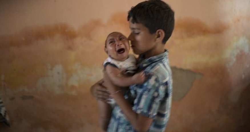 Zika virus: Study supports link to microcephaly Zika virus: Study supports link to microcephaly