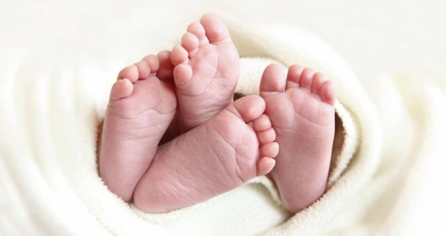 Vietnam twins found to have different fathers in rare case Vietnam twins found to have different fathers in rare case