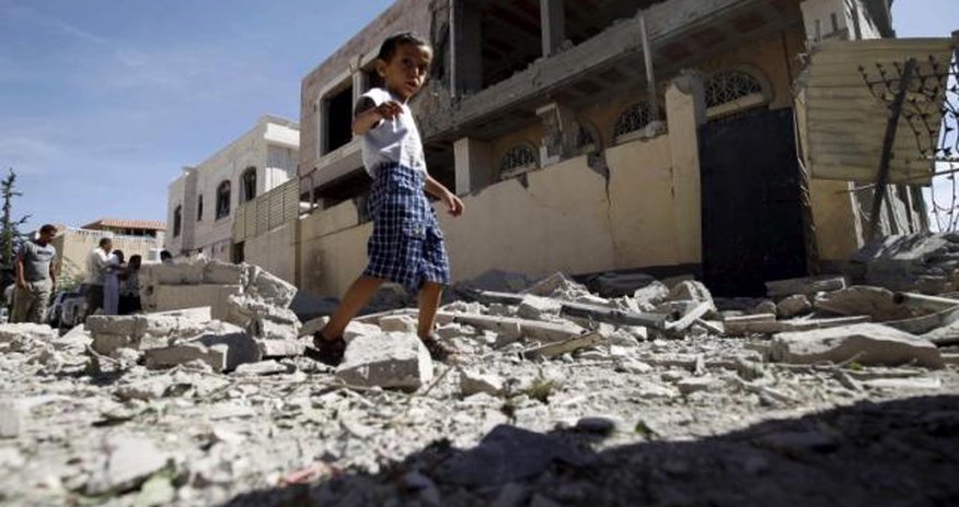 War in Yemen kills many children, leaves others malnourished War in Yemen kills many children, leaves others malnourished