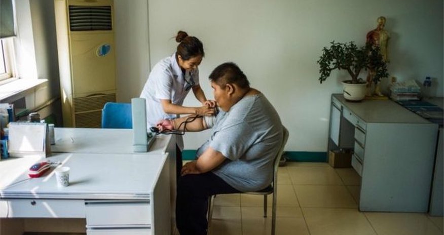 Obesity 'explosion' in rural youth, study warns Obesity 'explosion' in rural youth, study warns