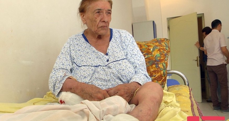 “Yanlış amputasiya olunan xəstənin sol ayağı da kəsiləcək” “Yanlış amputasiya olunan xəstənin sol ayağı da kəsiləcək”