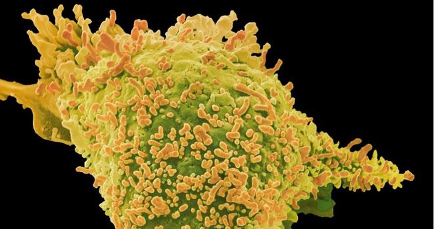 Cancer gene tests 'reveal family link' Cancer gene tests 'reveal family link'