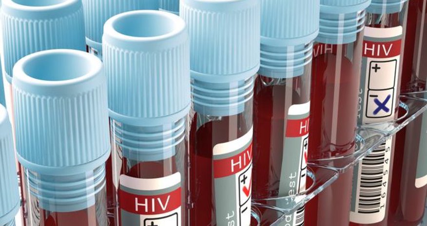 HIV effort let down by test shortages, says WHO HIV effort let down by test shortages, says WHO