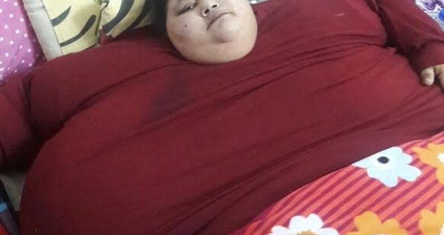 Doctor to operate on '500kg' Egyptian woman Doctor to operate on '500kg' Egyptian woman