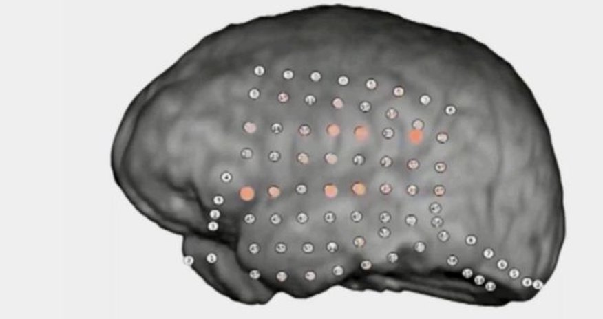 Brain's party noise filter revealed by recordings Brain's party noise filter revealed by recordings