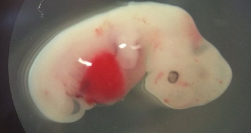 Human-pig 'chimera embryos' detailed Human-pig 'chimera embryos' detailed