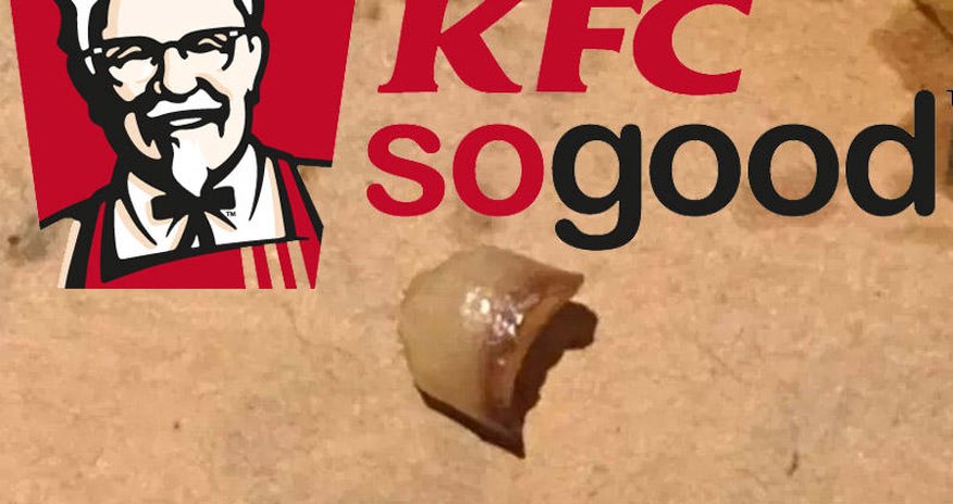 "KFC"də çipsinin içindən uşaq dişi cıxdı - FOTO "KFC"də çipsinin içindən uşaq dişi cıxdı - FOTO
