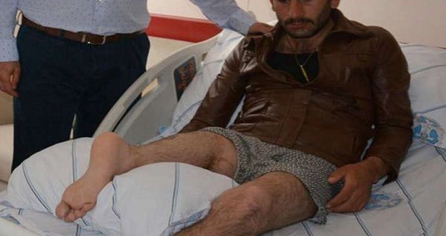 Qəribə hadisə: Həkimlər ayağını tərs tikdilər Qəribə hadisə: Həkimlər ayağını tərs tikdilər