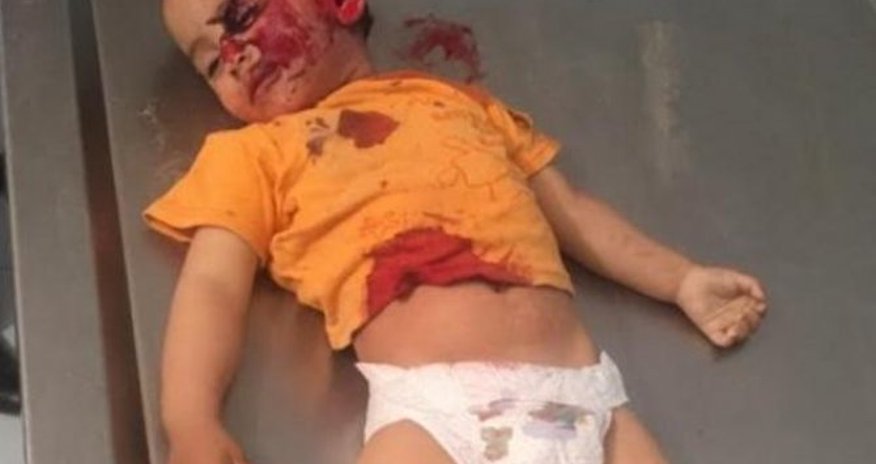 2 yaşlı Zəhranın ürəkparçalayan - FOTOSU 2 yaşlı Zəhranın ürəkparçalayan - FOTOSU