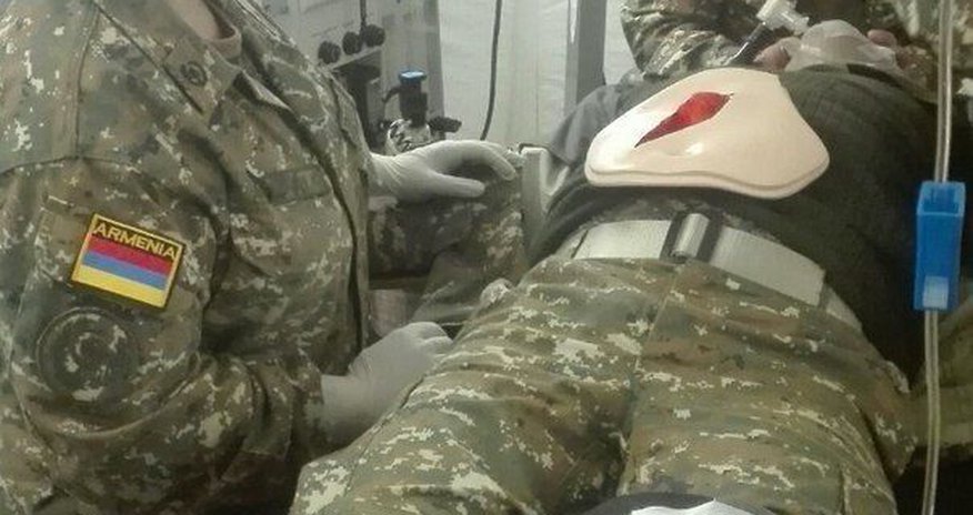 В Армении рассказали о состоянии своих раненых В Армении рассказали о состоянии своих раненых