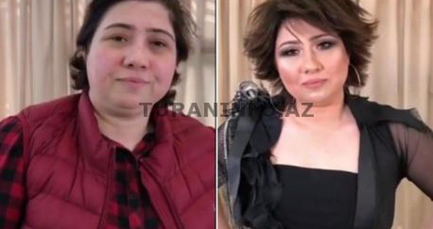 Aygün Bəylər tanınmaz hala düşdüv- VİDEO Aygün Bəylər tanınmaz hala düşdüv- VİDEO