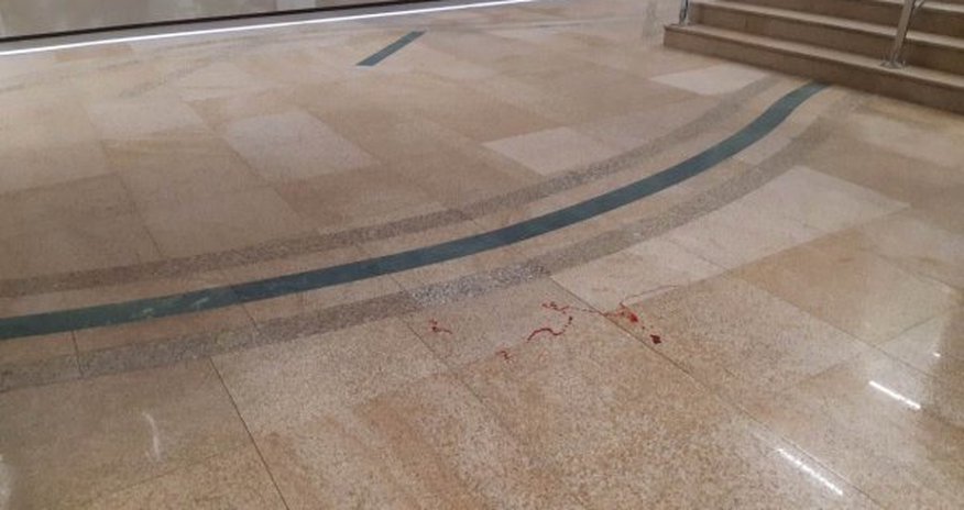 Bakı metrosunda qanlı hadisə - FOTO Bakı metrosunda qanlı hadisə - FOTO
