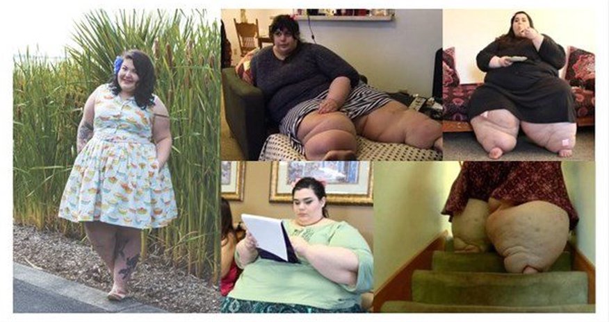 292 kilo olmuşdu, indiki halını görənlər şokda - FOTO 292 kilo olmuşdu, indiki halını görənlər şokda - FOTO