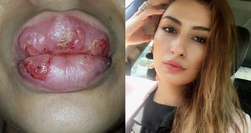 Elnarə Rzayeva daha bir xanımı bu hala saldı - FOTO Elnarə Rzayeva daha bir xanımı bu hala saldı - FOTO