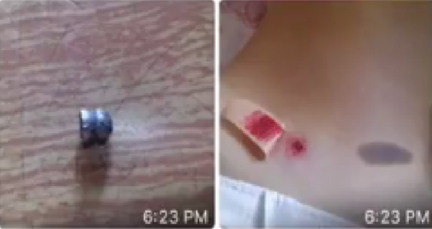 Bakıda qızlara atəş açan manyak peyda olub Bakıda qızlara atəş açan manyak peyda olub