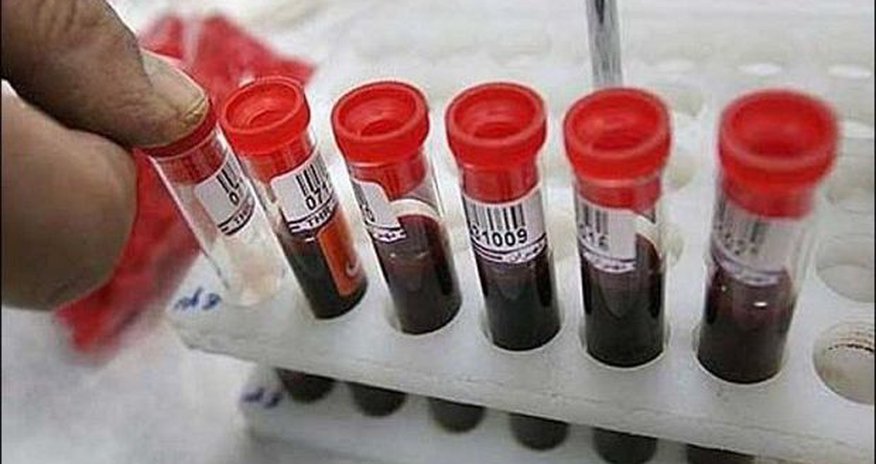 Названо число больных гемофилией в Азербайджане Названо число больных гемофилией в Азербайджане