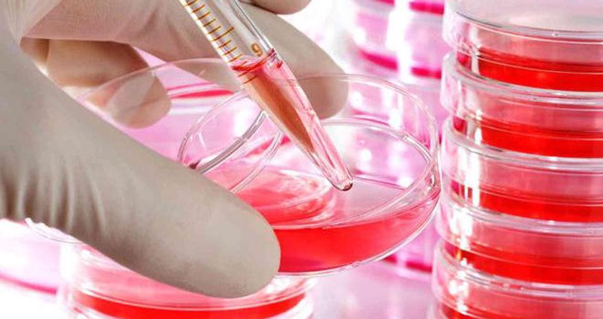 Azərbaycanda hemofiliyalı xəstələrlə bağlı statistika Azərbaycanda hemofiliyalı xəstələrlə bağlı statistika