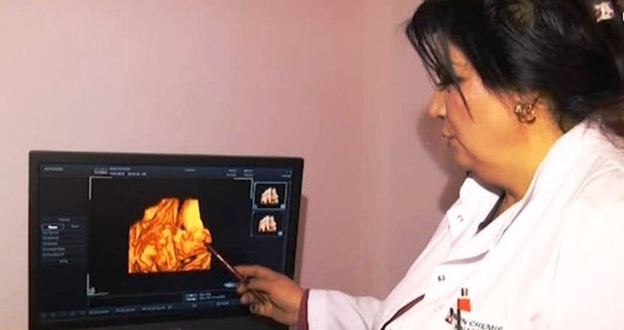 DİQQƏT! Uşağın cinsiyyətini öyrənmək qadağan olunur - VİDEO DİQQƏT! Uşağın cinsiyyətini öyrənmək qadağan olunur - VİDEO