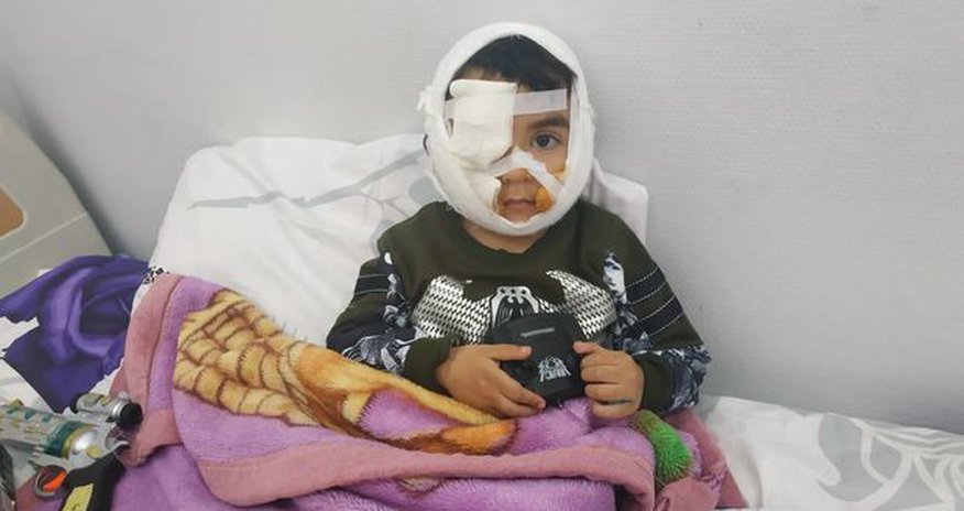 Üzünü it parçalayan Hüseynin atası: Uşağım şikəst oldu - FOTO Üzünü it parçalayan Hüseynin atası: Uşağım şikəst oldu - FOTO