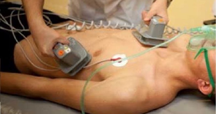 Ölən adama 5 min volt elektrik verdilər Ölən adama 5 min volt elektrik verdilər