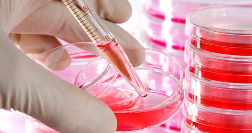 Agency for Agrarian Services talks spread of anthrax among cattle in Azerbaijan (EXCLUSIVE) Agency for Agrarian Services talks spread of anthrax among cattle in Azerbaijan (EXCLUSIVE)
