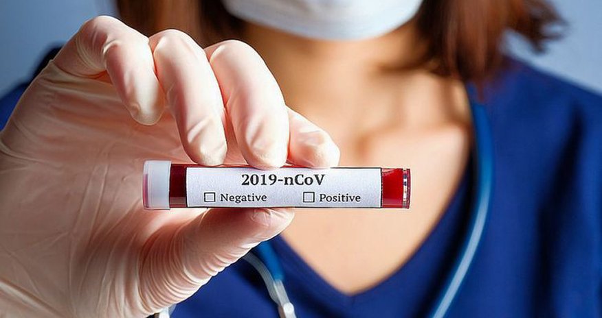 Çində koronavirusu 30 dəqiqəyə müəyyən edən cihaz hazırlanıb Çində koronavirusu 30 dəqiqəyə müəyyən edən cihaz hazırlanıb