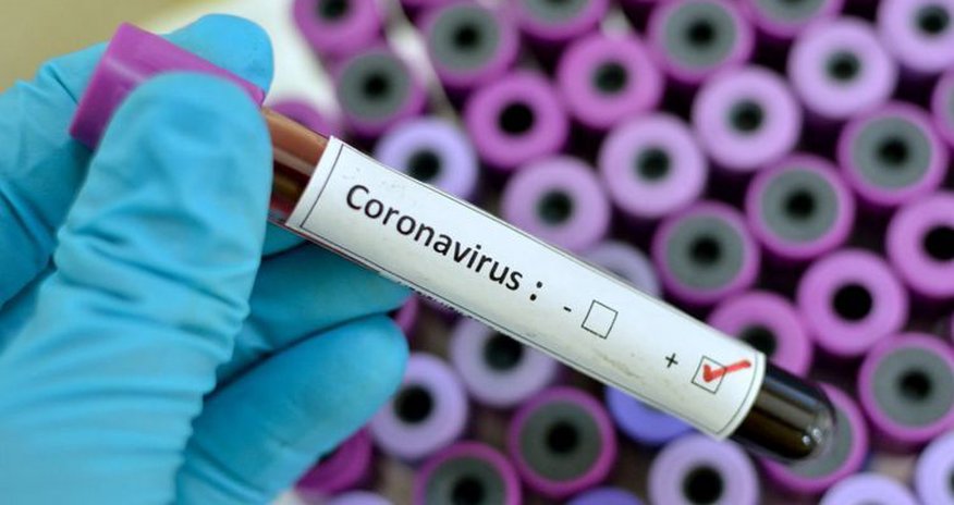 Koronavirus toxunduğumuz hər şeydən keçə bilər - VİDEO Koronavirus toxunduğumuz hər şeydən keçə bilər - VİDEO