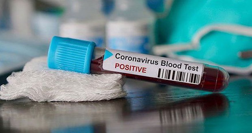 Koronavirusla bağlı araşdırmalara başlanıldı Koronavirusla bağlı araşdırmalara başlanıldı