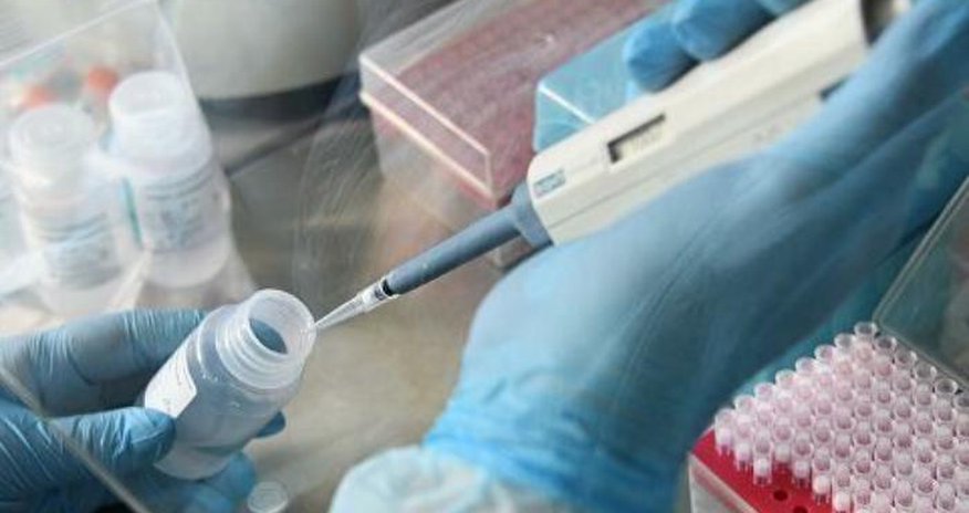 Koronavirus testindən necə keçmək olar? - TƏBİB-dən AÇIQLAMA Koronavirus testindən necə keçmək olar? - TƏBİB-dən AÇIQLAMA