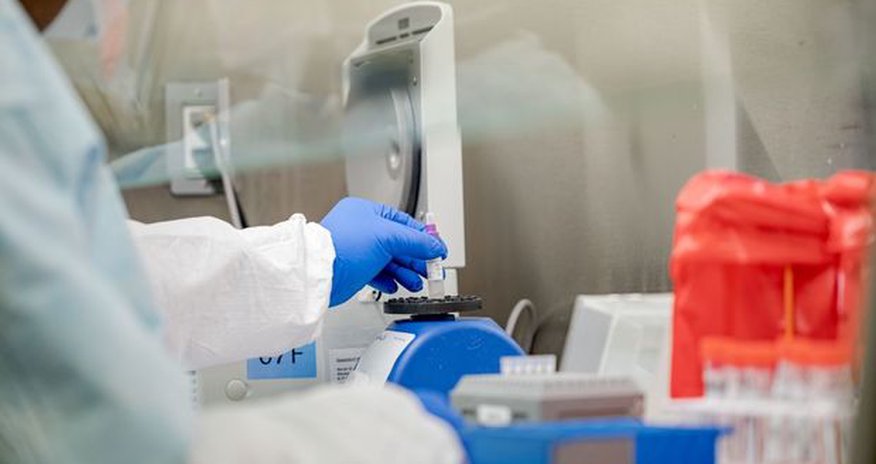 Koronavirusun Azərbaycanda yayılmasının maksimuma çatdığı vaxt açıqlandı - RƏSMİ Koronavirusun Azərbaycanda yayılmasının maksimuma çatdığı vaxt açıqlandı - RƏSMİ