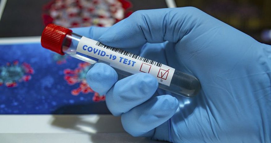 Azərbaycanda daha 106 nəfərdə koronavirus aşkarlandı Azərbaycanda daha 106 nəfərdə koronavirus aşkarlandı