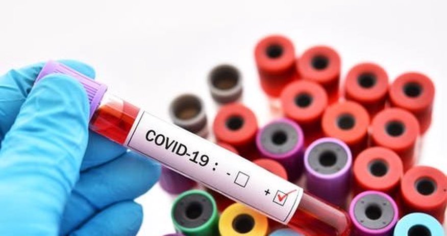 SON DƏQİQƏ: Jurnalistin ailəsində koronavirus aşkarlandı SON DƏQİQƏ: Jurnalistin ailəsində koronavirus aşkarlandı