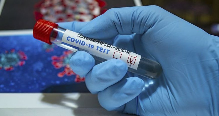 В Британии еще 202 человека умерли от COVID-19 В Британии еще 202 человека умерли от COVID-19