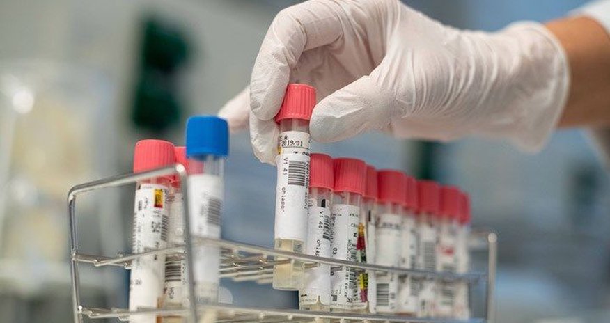 "Koronavirus zəifləyib və əvvəlki qədər ölümcül deyil” - Məşhur həkim "Koronavirus zəifləyib və əvvəlki qədər ölümcül deyil” - Məşhur həkim