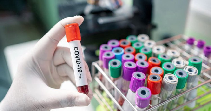 Azərbaycanda ən son koronavirus statistikası Azərbaycanda ən son koronavirus statistikası
