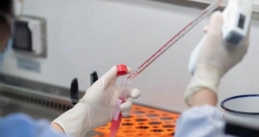 В Азербайджане выявлено 279 новых случаев инфицирования COVID-19, скончались еще шесть человек В Азербайджане выявлено 279 новых случаев инфицирования COVID-19, скончались еще шесть человек