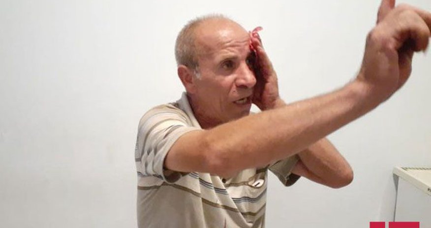 Xalq artistinin qardaşı döyüldü — FOTOLAR Xalq artistinin qardaşı döyüldü — FOTOLAR