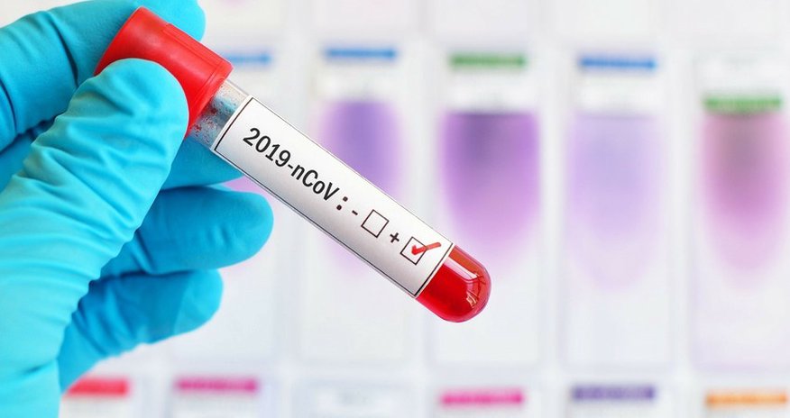 Работники сферы услуг в Грузии сдадут тесты на коронавирус Работники сферы услуг в Грузии сдадут тесты на коронавирус