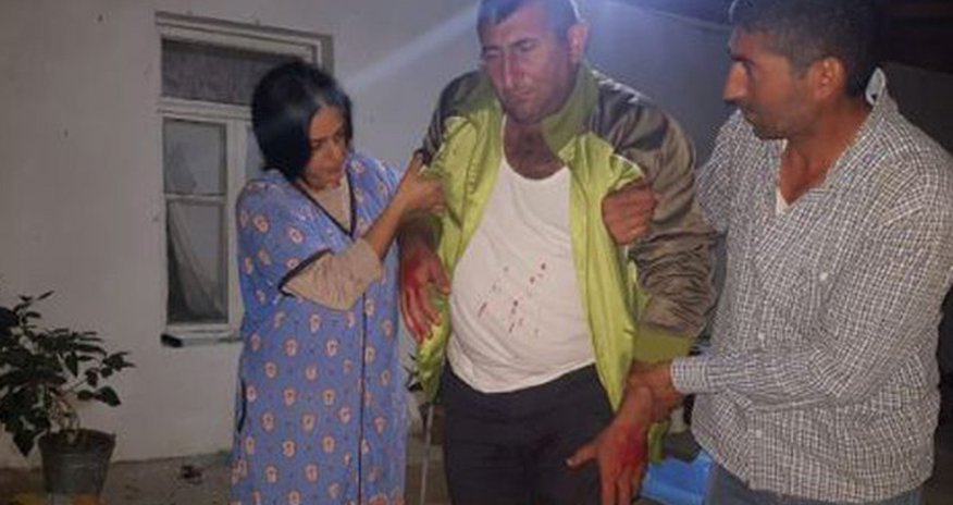 Ermənilərin yaraladığı mülki vətəndaşımızın - Fotosu Ermənilərin yaraladığı mülki vətəndaşımızın - Fotosu
