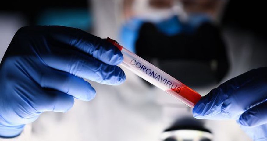 Türkiyədə koronavirus peyvəndinin birinci klinik mərhələsi başladı Türkiyədə koronavirus peyvəndinin birinci klinik mərhələsi başladı