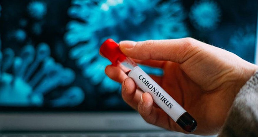 Koronavirusun yeni simptomu məlum olub Koronavirusun yeni simptomu məlum olub