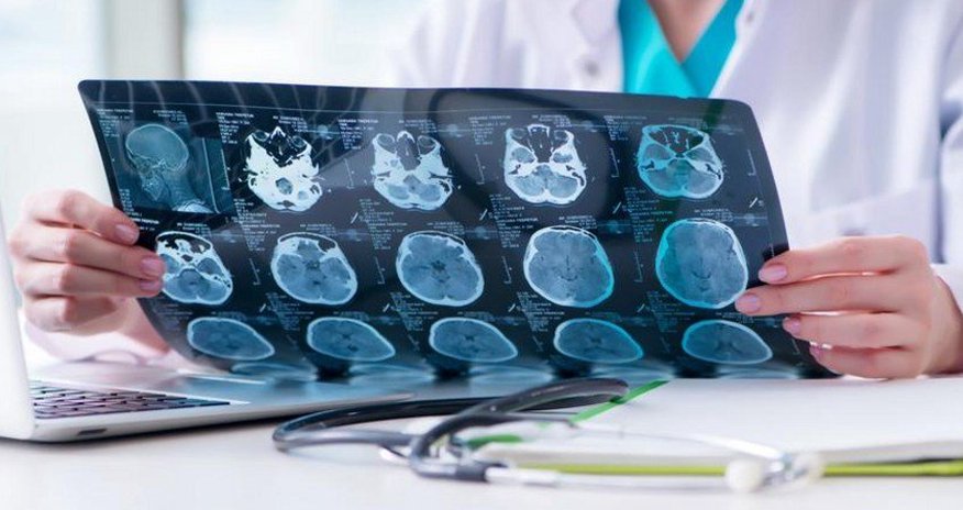 Koronavirus epidemiyasının beyin sağlamlığına da mənfi təsir etdiyi ortaya çıxdı Koronavirus epidemiyasının beyin sağlamlığına da mənfi təsir etdiyi ortaya çıxdı