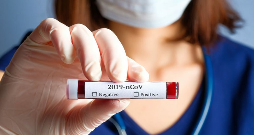 Müəllimlər kütləvi şəkildə COVID-19 testindən keçiriləcək? - Nazirdən açıqlama Müəllimlər kütləvi şəkildə COVID-19 testindən keçiriləcək? - Nazirdən açıqlama