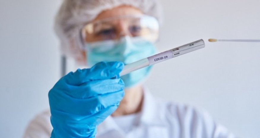 Son sutkada 7 mindən çox test aparılıb Son sutkada 7 mindən çox test aparılıb
